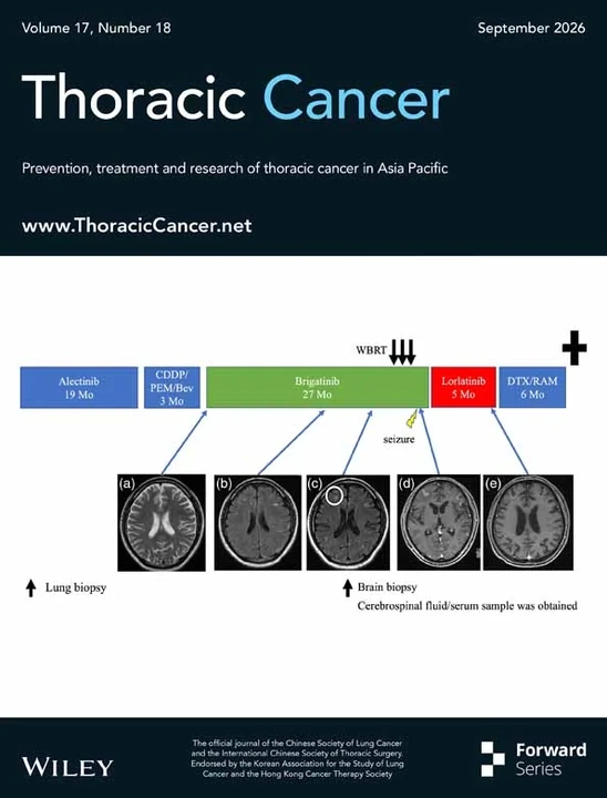 Thoracic Cancer journal cover