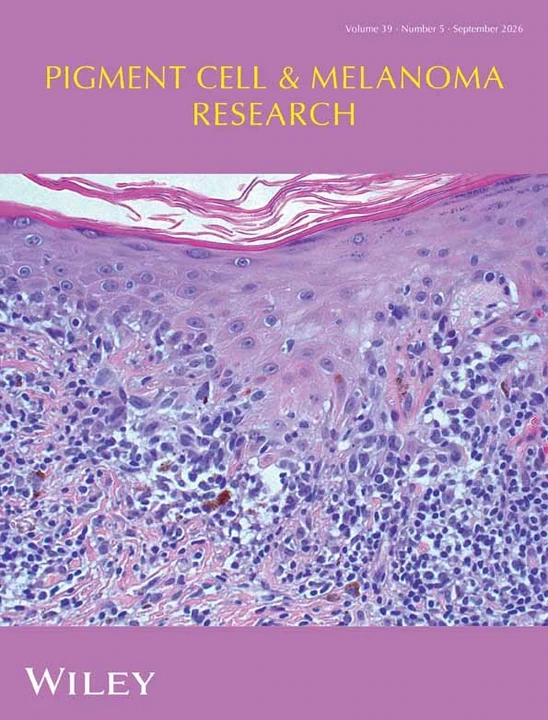 Pigment Cell & Melanoma Research journal cover