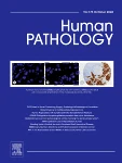 HUMAN PATHOLOGY journal cover