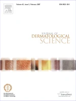 JOURNAL OF DERMATOLOGICAL SCIENCE journal cover