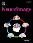NEUROIMAGE journal cover